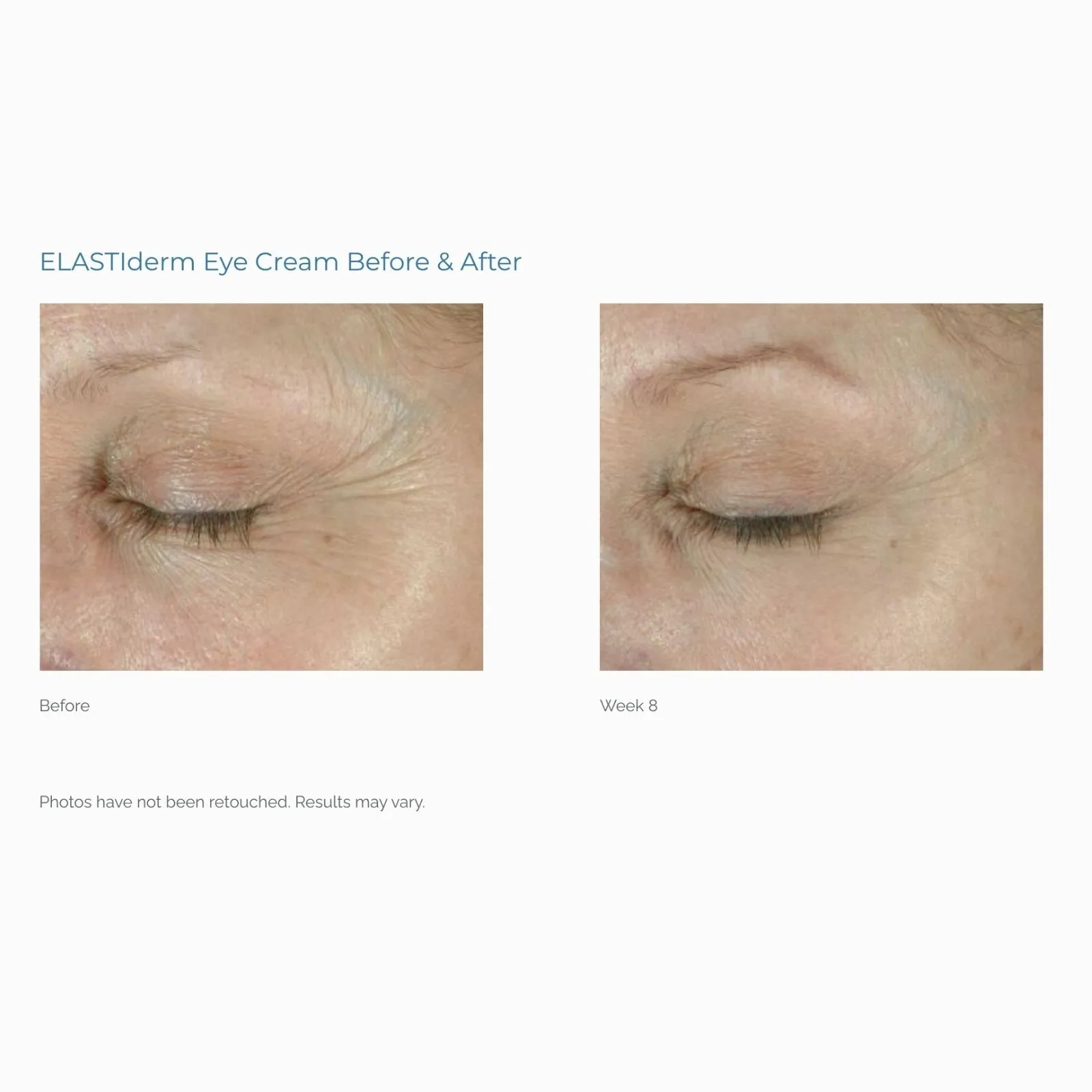 Obagi | ELASTIderm Eye Cream 15g